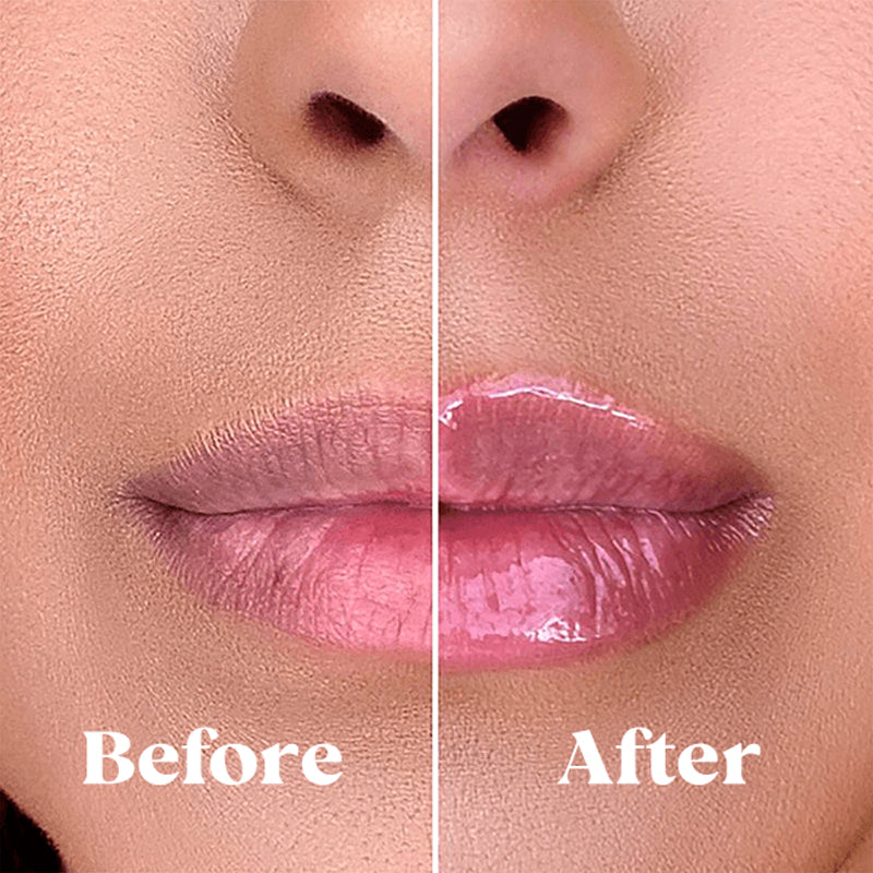 Full Lips 24/7 – Natuurlijk Volle Lippen Dag en Nacht