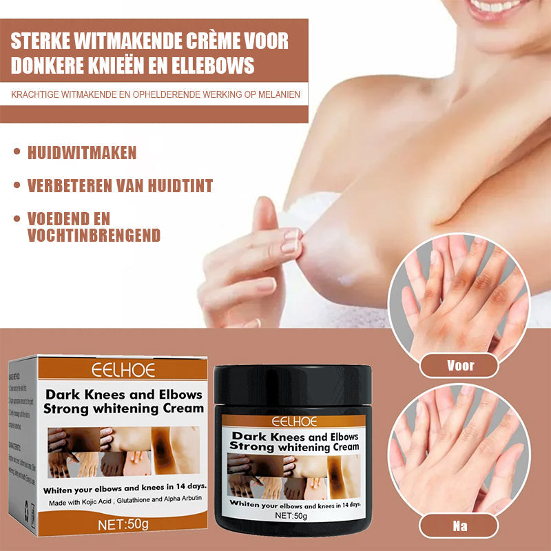 Donkere knieën en ellebogen Sterke blekende crème