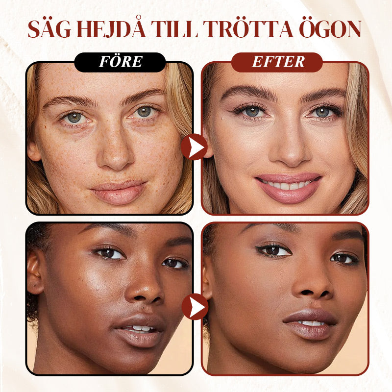 Oogcontour Corrector - Verminder Rimpels & Donkere Kringen, 30 ml