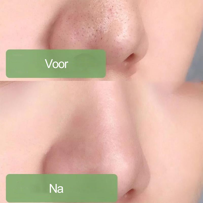 MatchaClean – Stickmasker voor Stralende Huid