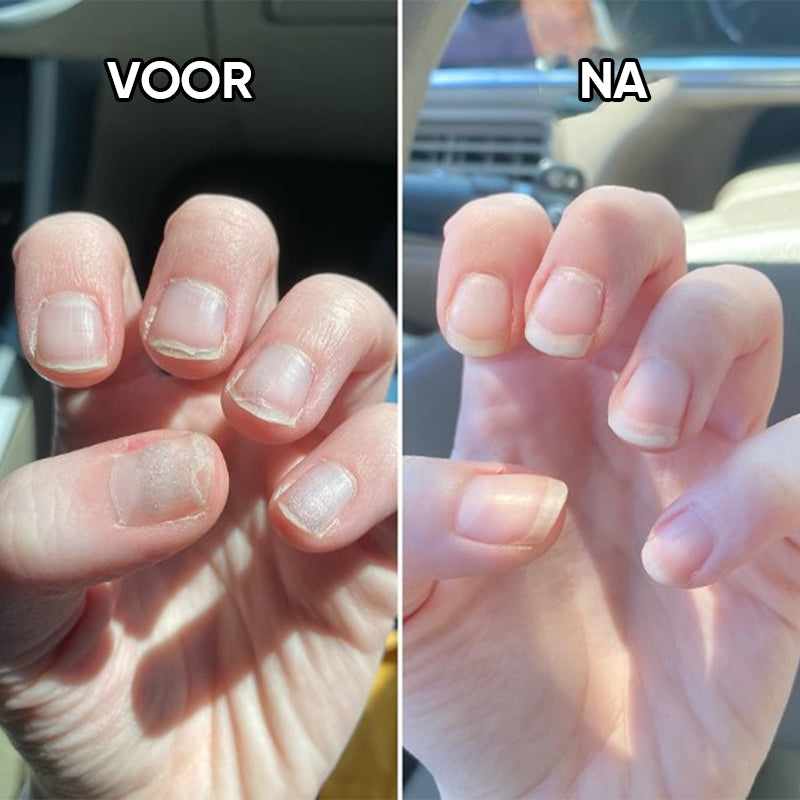 Nagel Voedingsolie Pen