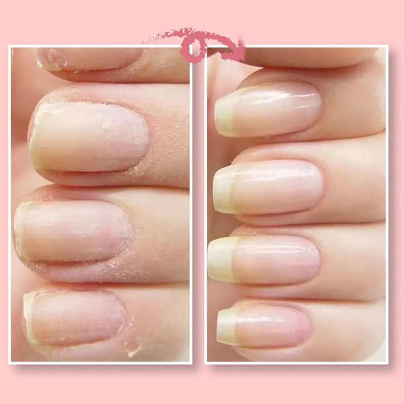Beschermende gel voor nagelreparatie | 1+1 GRATIS