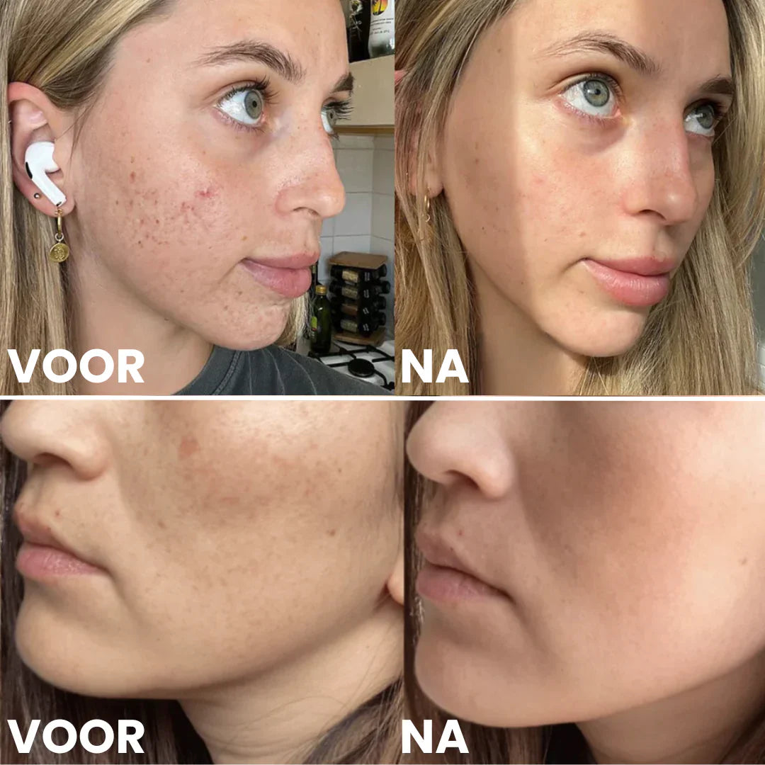 Collageen Gezichtsmaskers | VOLUME KORTING