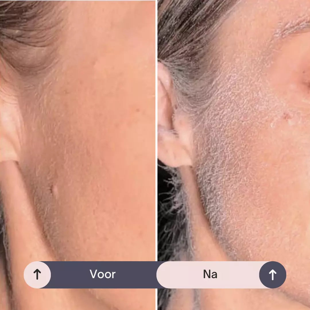 Dermaplaning Set – Zacht, Glad & Haarvrij in Minuten