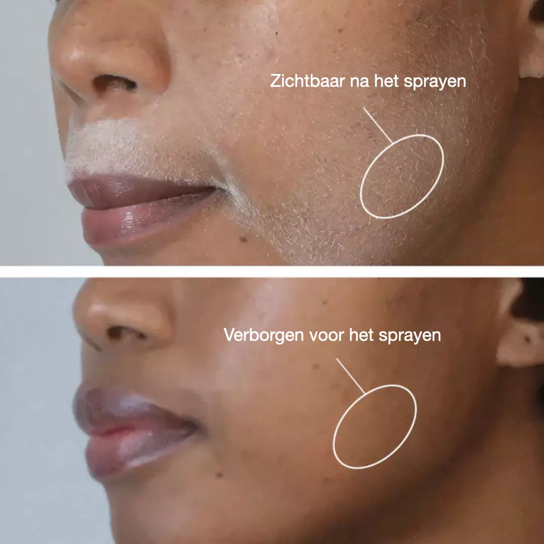 Dermaplaning Set – Zacht, Glad & Haarvrij in Minuten