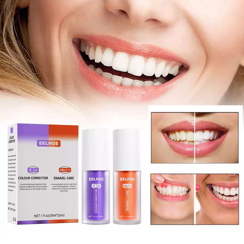 Violet Smile – Direct Wittere Tanden zonder Bleken