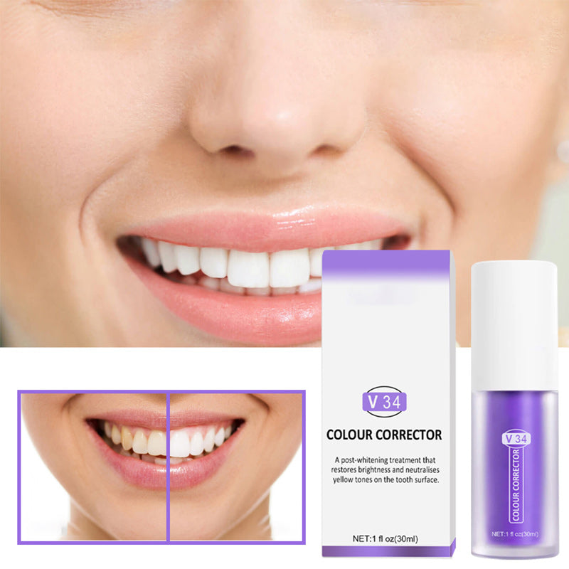 Violet Smile – Direct Wittere Tanden zonder Bleken