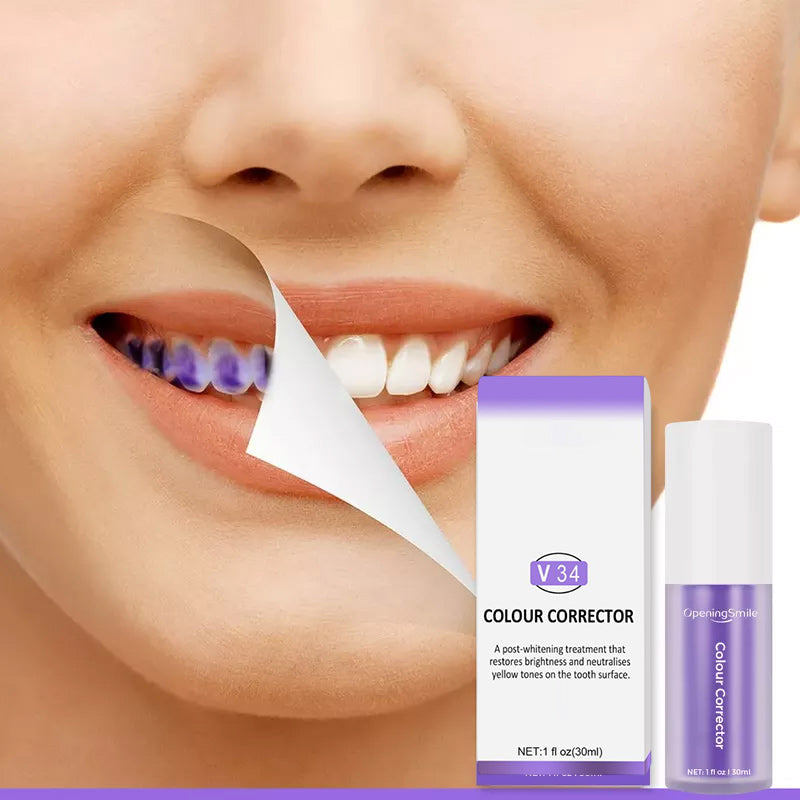 Violet Smile – Direct Wittere Tanden zonder Bleken