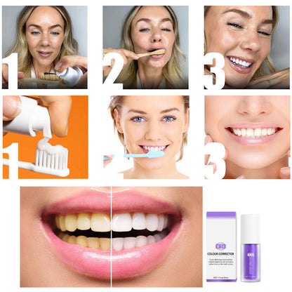 Violet Smile – Direct Wittere Tanden zonder Bleken