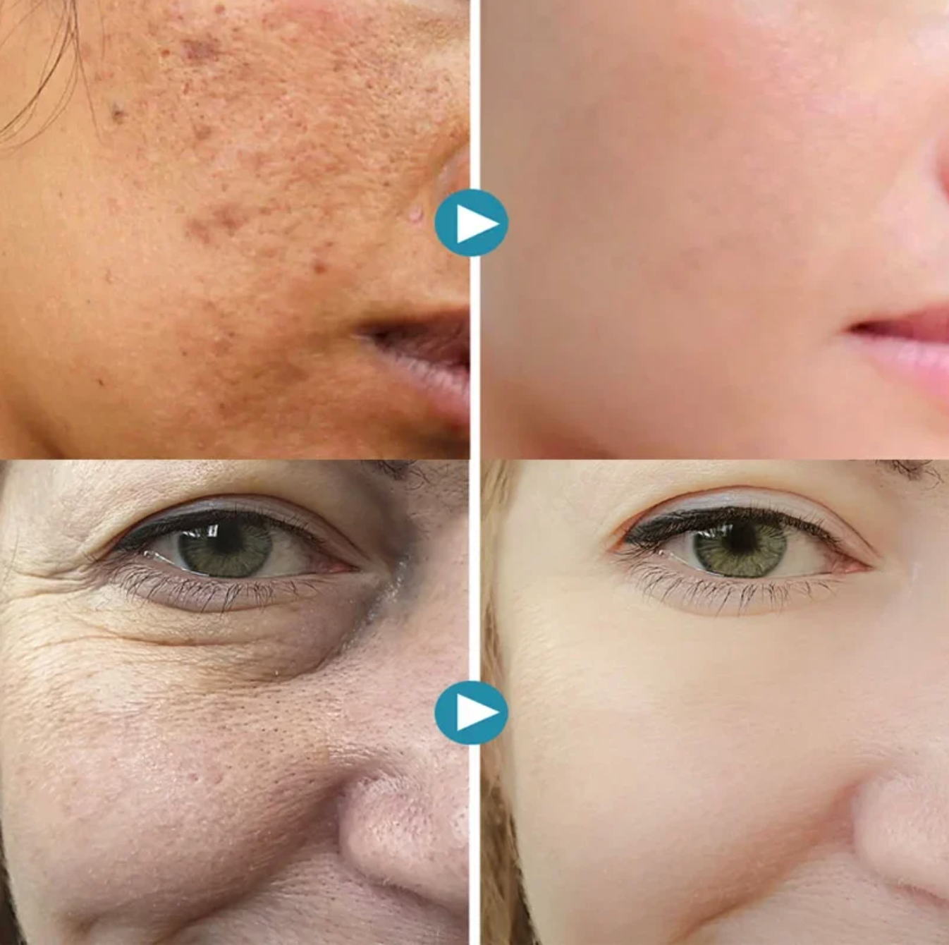 Perfect Skin Stick – Poriën & Onzuiverheden| 1+1 GRATIS