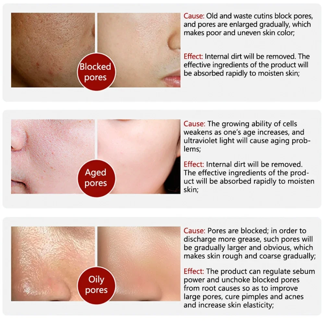 Perfect Skin Stick – Poriën & Onzuiverheden| 1+1 GRATIS