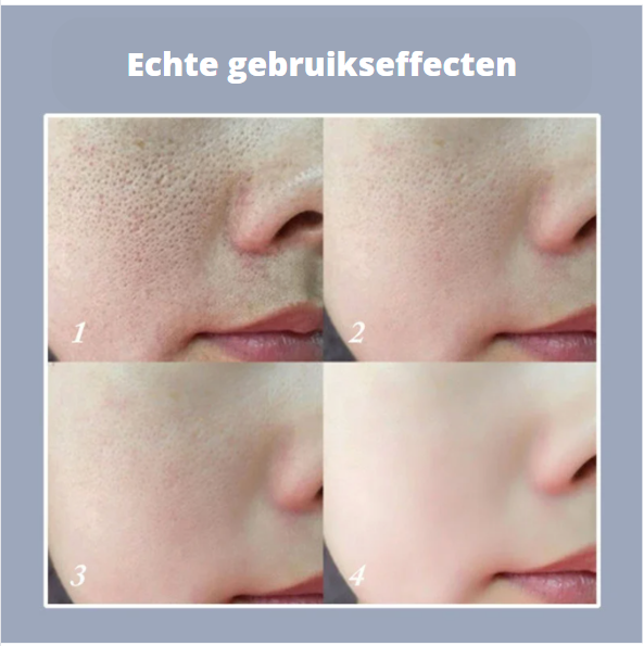 Perfect Skin Stick – Poriën & Onzuiverheden| 1+1 GRATIS
