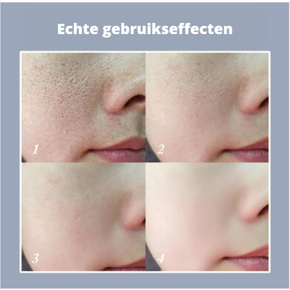 Perfect Skin Stick – Poriën & Onzuiverheden| 1+1 GRATIS